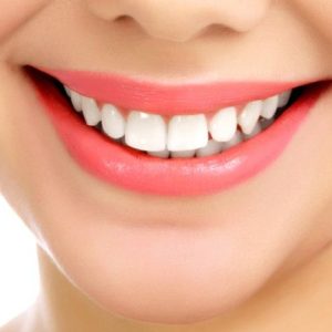 جهاز تثبيت متحرك