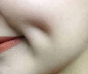 غمازات خدود تجميلية