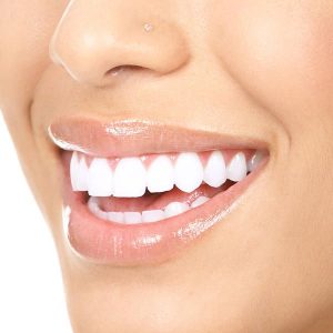 مادة فلورايد فارنش للسن الواحد