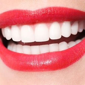 علاج عصب سن حلفي - اللب عفن