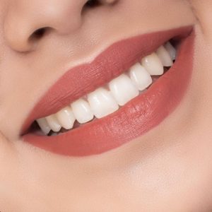 تاج سن سيراميك / خزف