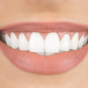 تنظيف جير (جلسة واحدة)