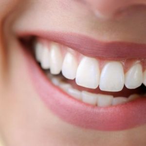 تقويم أسنان فكين لامرئي