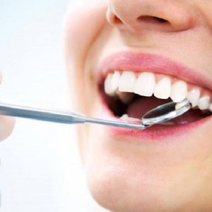 تلميع أسنان (بروفيلاك)