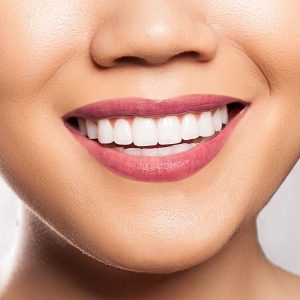 زراعة لثة (حسب المساحة)