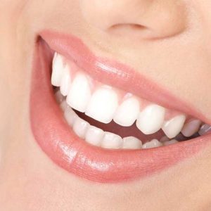 اعادة تثبيت جسر