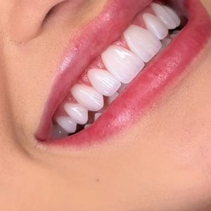 وجه لومينير تجميلي