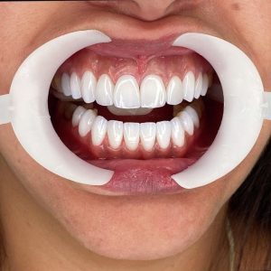 غسل وارواء الاقنية طواريء