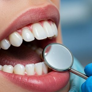 فصل السن وخلعه منفصل